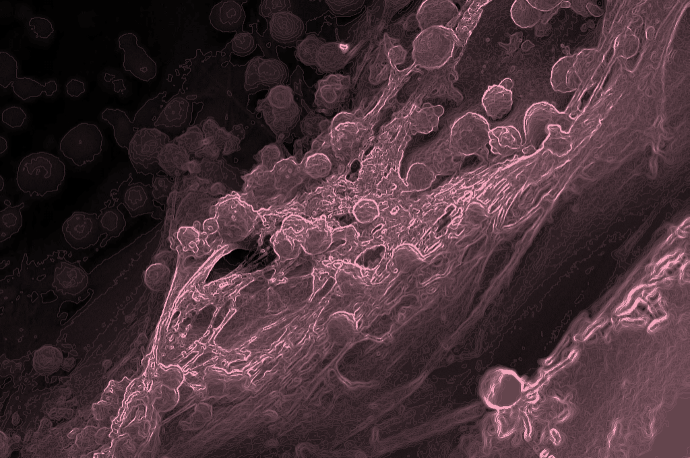 Enlarged view: Dilara Perver Bone Marrow Microphysiological Niches Heamtopoietic stem cells Mesenchymal Stromal Stem Cells