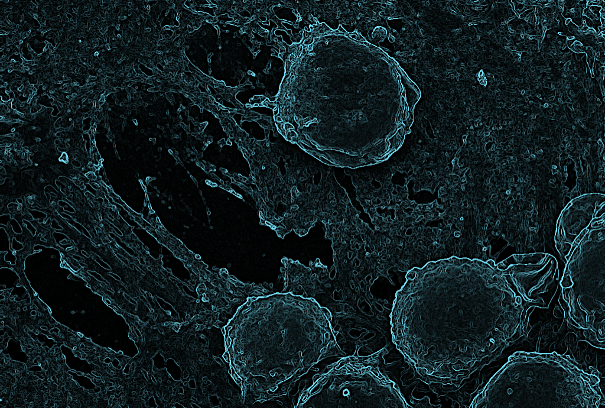 Enlarged view: Dilara Perver Hematopoietic stem cell extracellular matrix bone marrow